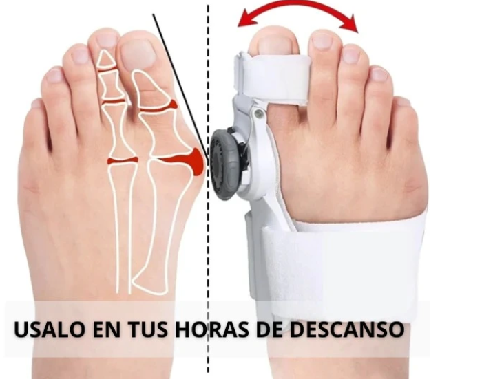 CORRECTOR DE JUANETES PRO ¡MEJORA TUS PIES DESDE EL PRIMER PASO!